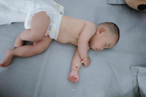台湾宝宝脸上有白色斑块